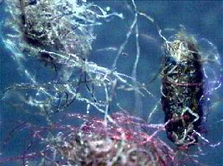Click to enlarge Morgellons lesion fibers