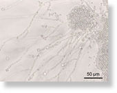 Candida