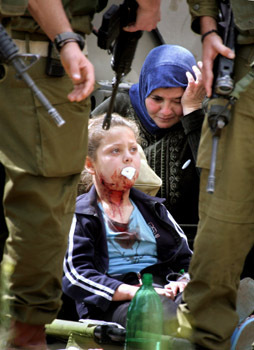 child shot