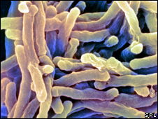TB bacteria