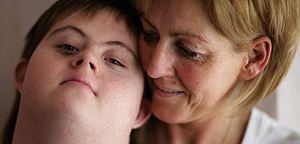 Jamie Bauld who has Downs Syndrome