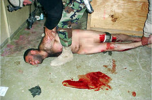 Tortured man