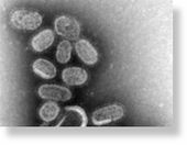 H1N1 virus