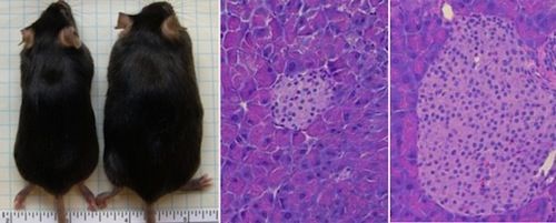 Normal Gut Flora