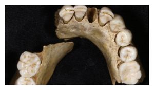 Click to enlarge Neanderthal Teeth