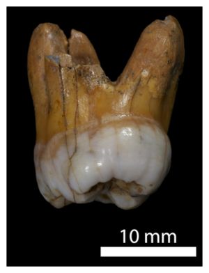 molar_120830.jpg