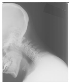 neck_x_ray.jpg