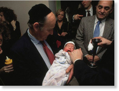 circumcision 