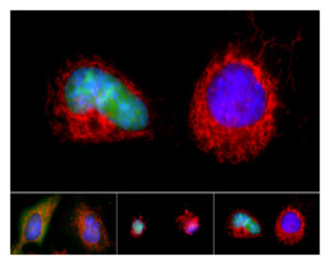 apoptosis.jpg