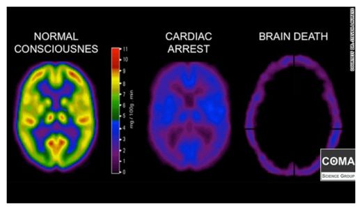 Brain Scans