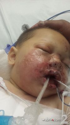 baby injured by raid