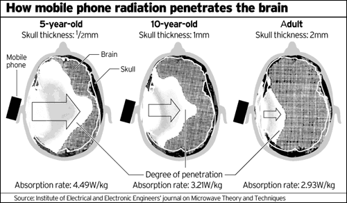 radiation through brain