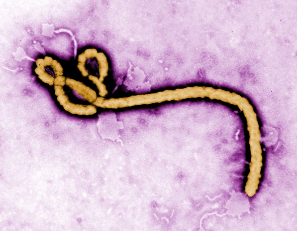 Ebola micrograph CDC
