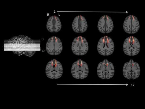 brain scans, delay gratification