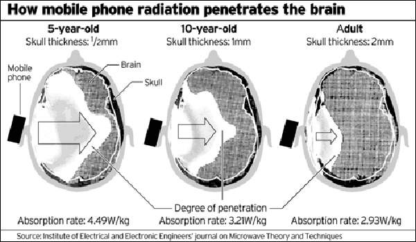 radiation brains