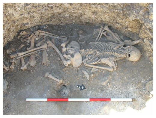 Female Skeleton