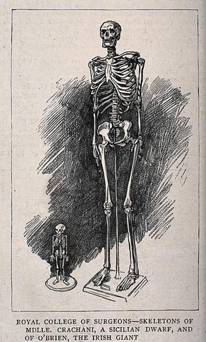 Click to enlarge skeleton giant