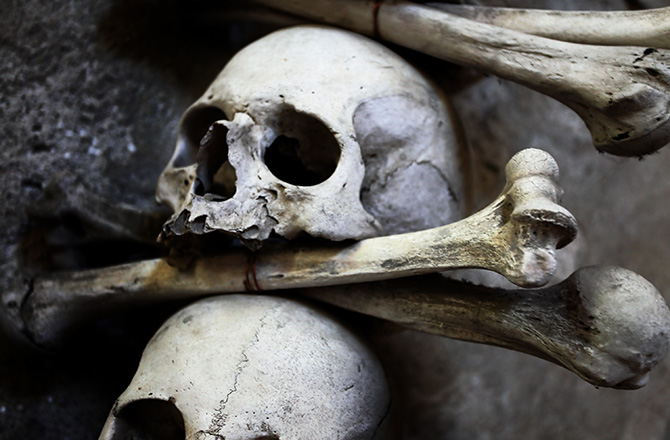 human skull and bones
