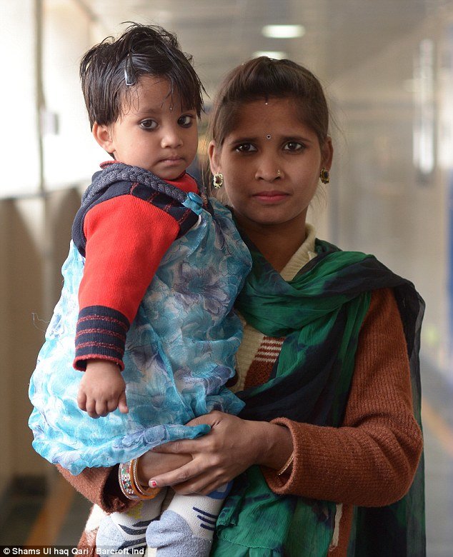 Varsha suffers from a rare condition called polymelia, which causes a person to be born with extra limbs, often arms or legs. She had an extra limb growing sideways out of the left side of her back