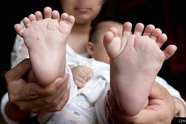 chinese baby's toes