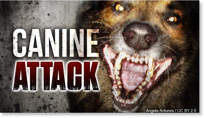 Woman in critical condition after pit bull attack in Rochester, New York