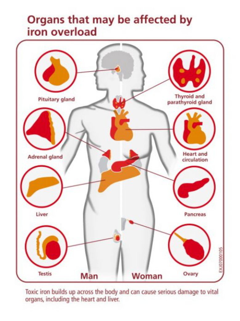 antidote for iron toxicity