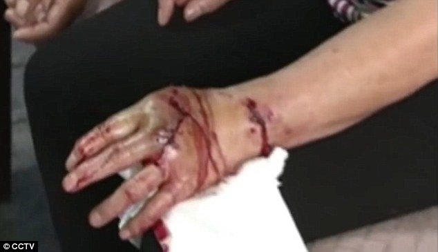 Click to enlarge The dog attacked more than 20 people during its rampage. Its youngest victim was just eight