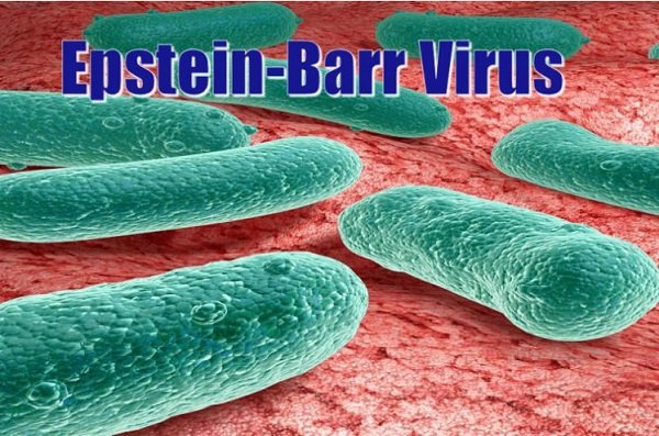 epstein barr virus
