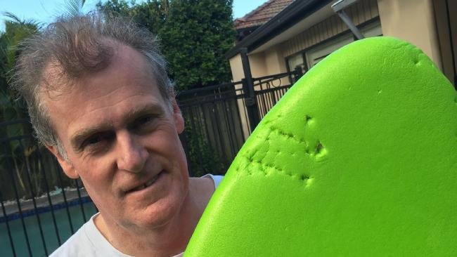 Click to enlarge Peter Fitzhardinge with the board bitten by a seal at Manly