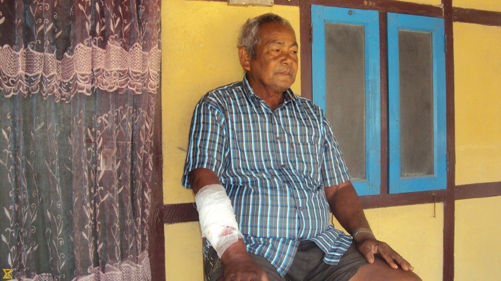 Click to enlarge Leopard attack victim