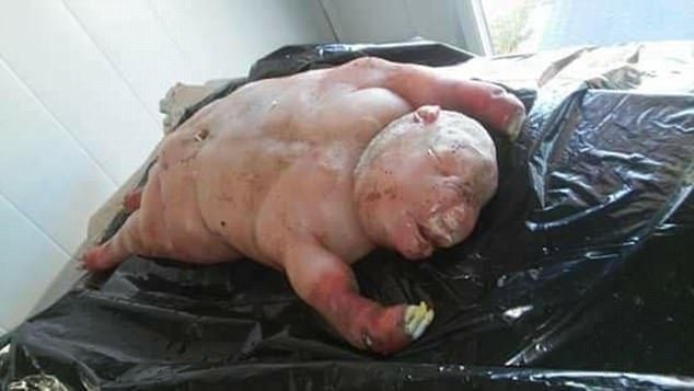 Click to enlarge Many of the 4,000 residents and farmers of Lady Frere in Eastern Province, South Africa , were convinced that bestiality and witchcraft had led to the birth of the creature