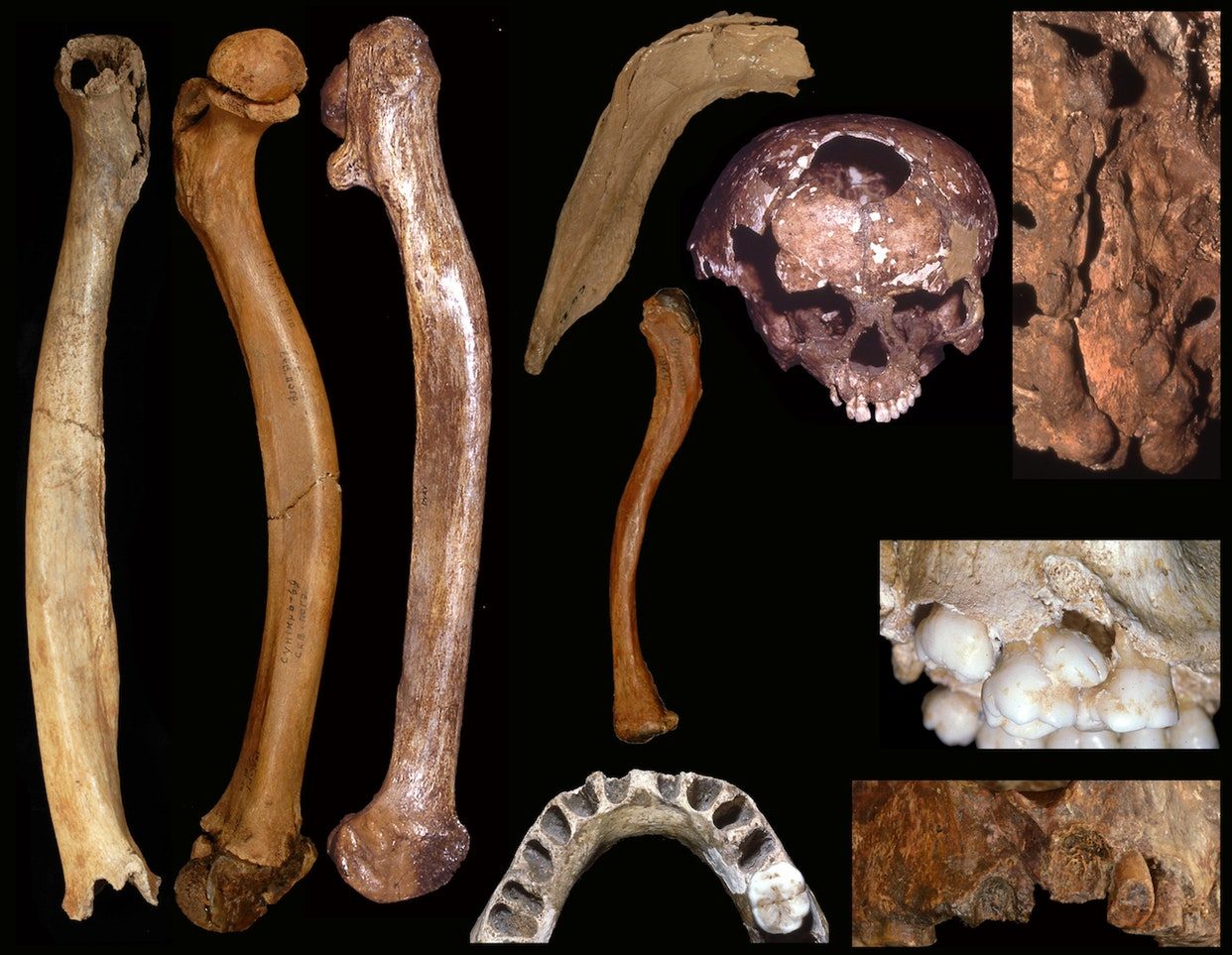 Ancient Bone Abnormalities