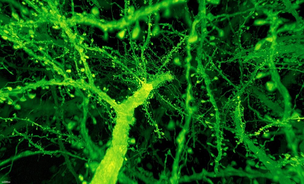 Click to enlarge dendritic spines