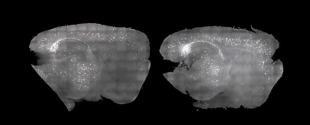 mouse brains alzheimer's plaques