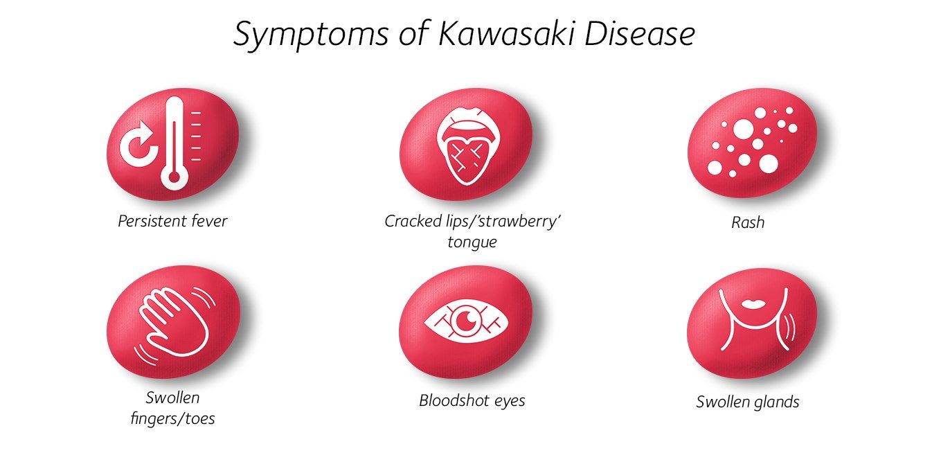 kawasaki disease symptoms list