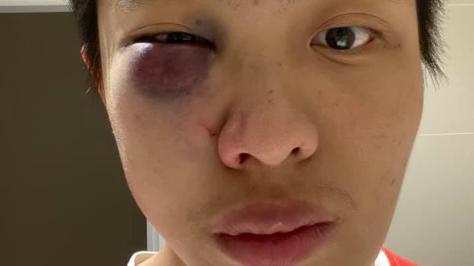Jonathan Mok, Chinese student attacked