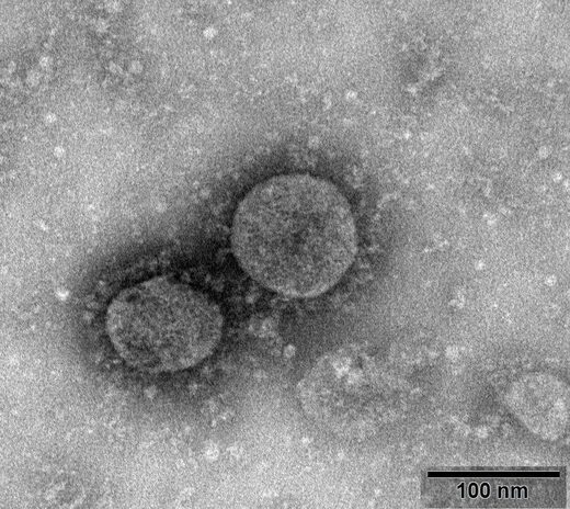 No, The CDC Did Not Admit That SARS-CoV-2 Has Not Been Isolated