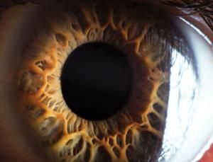 Eye Diagnose