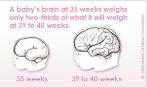 A baby's brain 