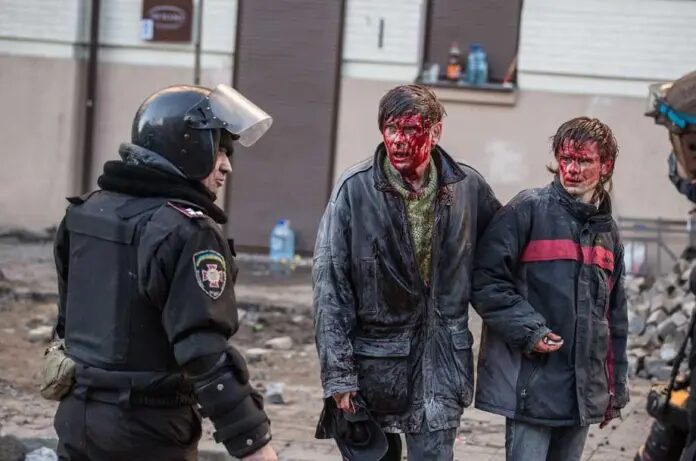 injured civilians in Ukraine conflict