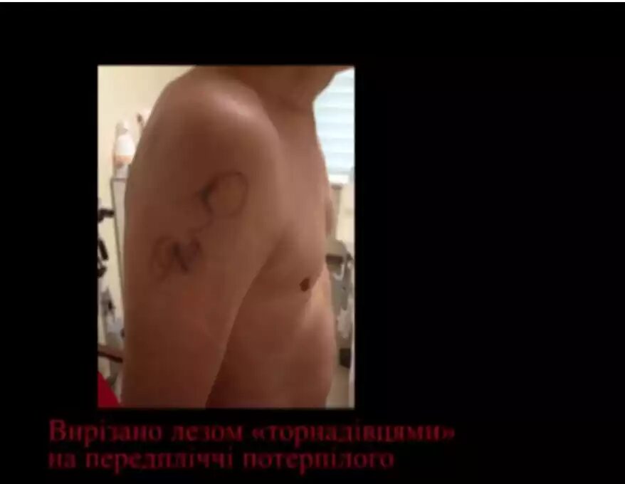 torture victim ukraine
