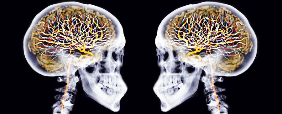 brain scan neurological