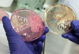 A lab technician holds a bacteria culture