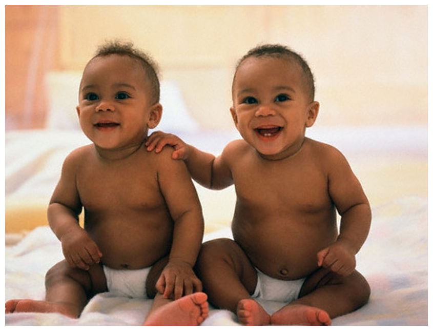Twin Births Doubled In Three Decades In U S Science Technology twin-births-doubled-in-three-decades-in-u-s-science-technology