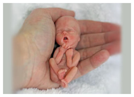 Click to enlarge Fetus