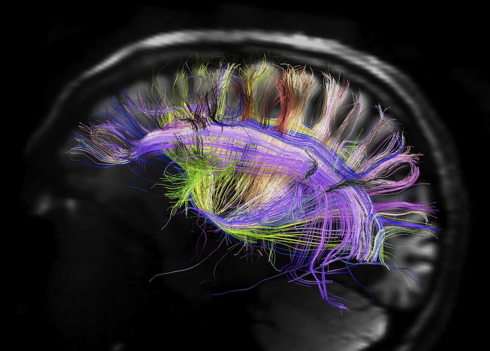 Click to enlarge Human Brain