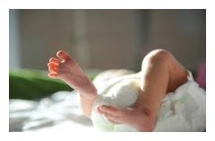 Click to enlarge Preterm Delivery