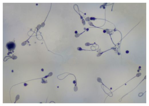 Human sperm cells