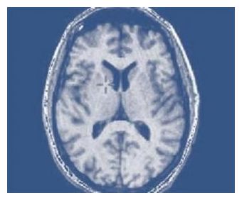 Click to enlarge Brain
