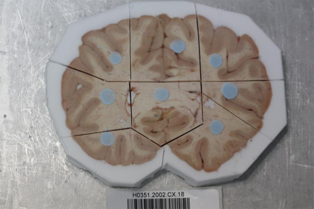 Click to enlarge Brain Slice